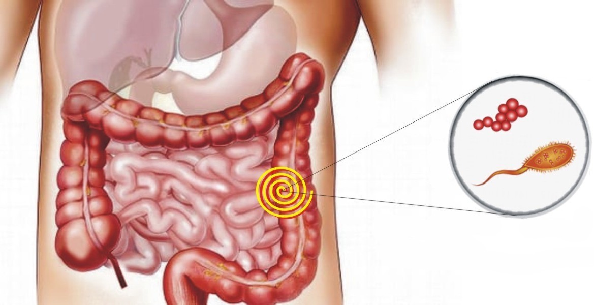 Disbiosi intestinale e intestino permeabile